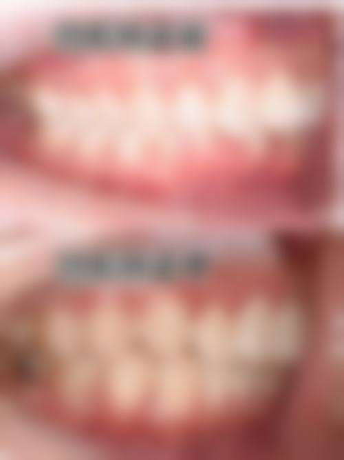 擅长项目详解