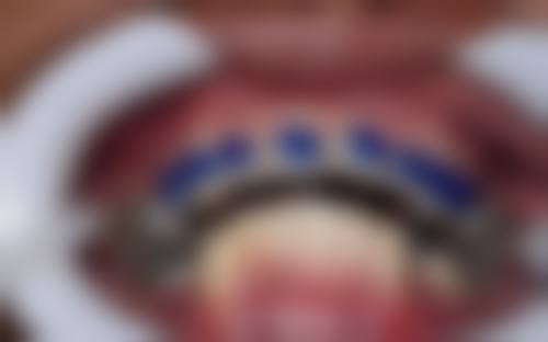 FAQ：关于成都金琴口腔门诊部蔡江宏的常见问题