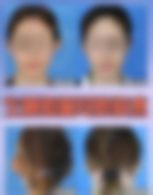 常见问题解答