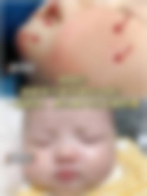 预约优惠活动