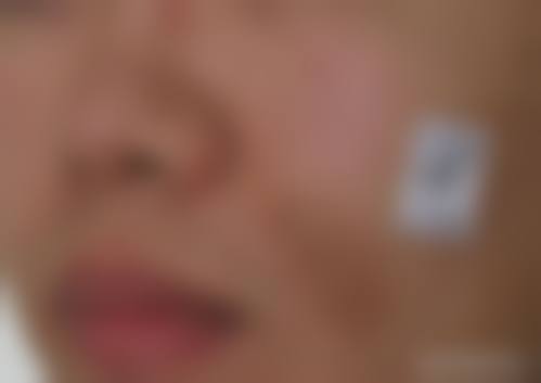 临床实例分享