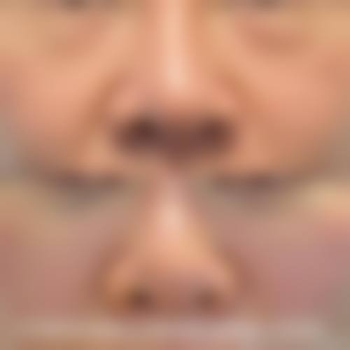 预约优惠活动