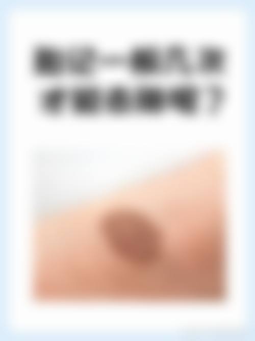 临床实例分享