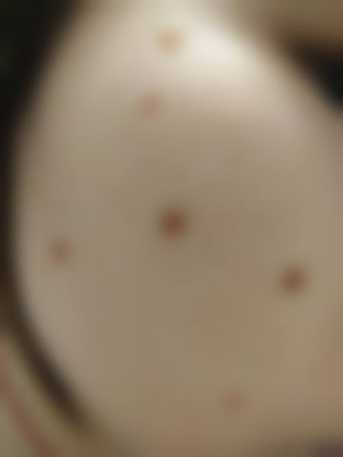 临床实例分享