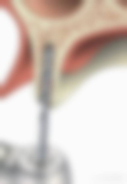 预约优惠活动