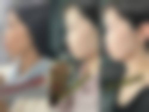 结尾预约号召：成都金琴口腔门诊部蔡江宏