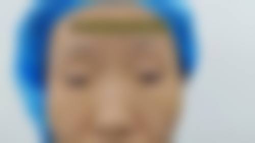 擅长项目详解:方建中医生精通哪些眼科技术?