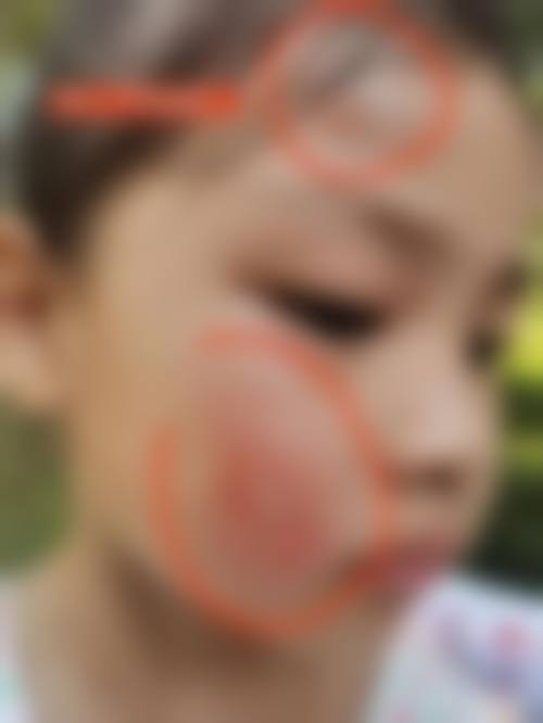 患者真实评价
