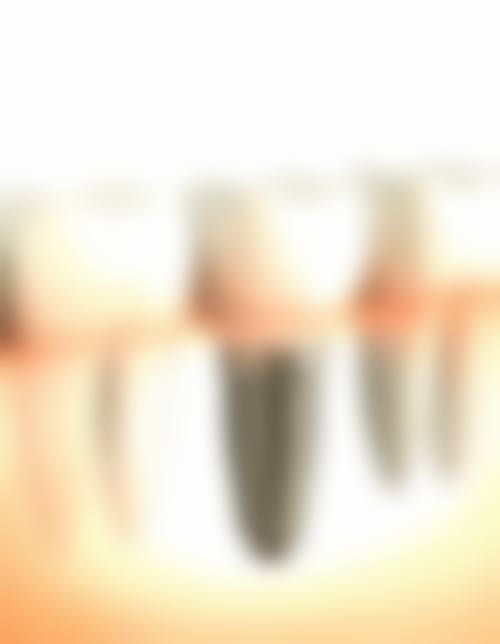 临床实例分享:汪成林+四川大学华 西口腔医(学)院+核心项目