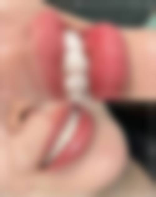 结尾预约号召:哈尔滨思美尔口腔门诊部黄晨
