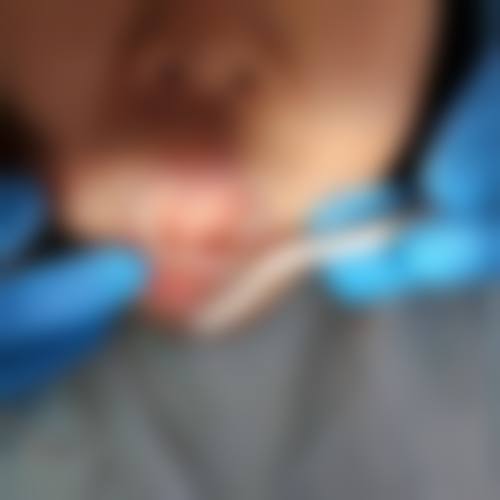 擅长项目详解