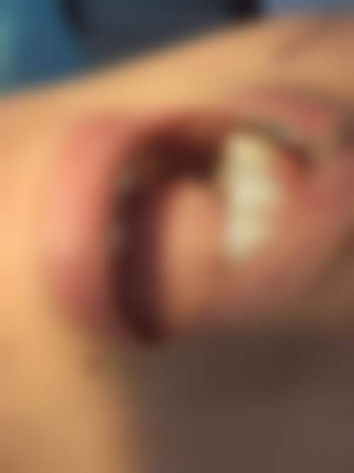 擅长项目详解