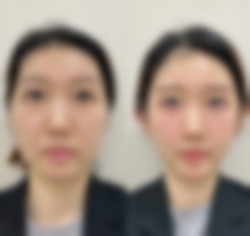 总结与到店预约号召