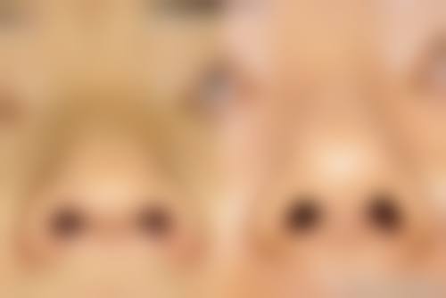诊疗特色总结:青岛大麦植发(原科发源)
