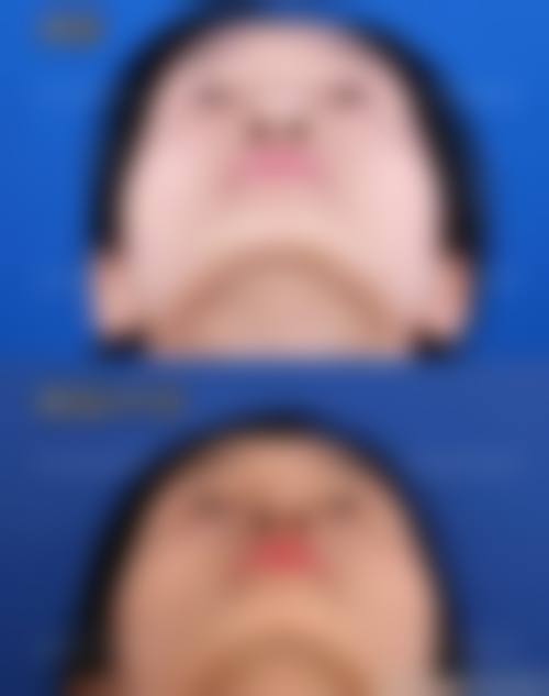 患者真实评价:周国栋医生