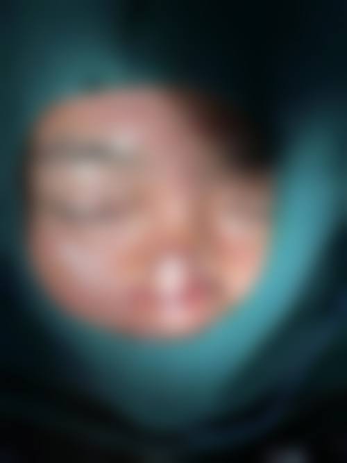 诊疗特色总结:刘子恒医生的技术优势在哪里?