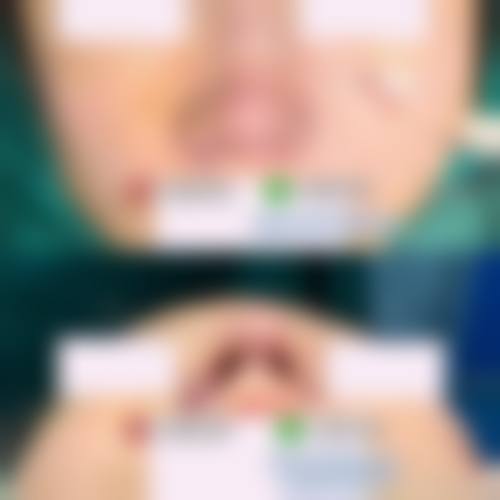 透明价格体系与近期优惠活动详情