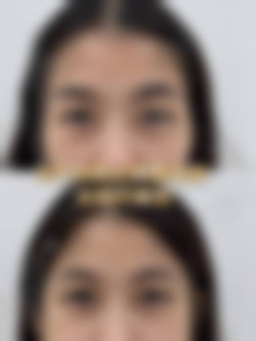 优惠活动详情