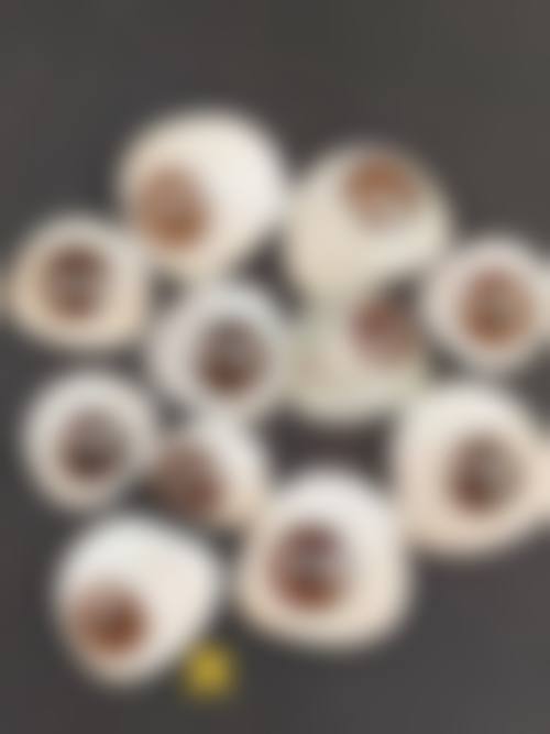 主流屈光项目与透明价格体系