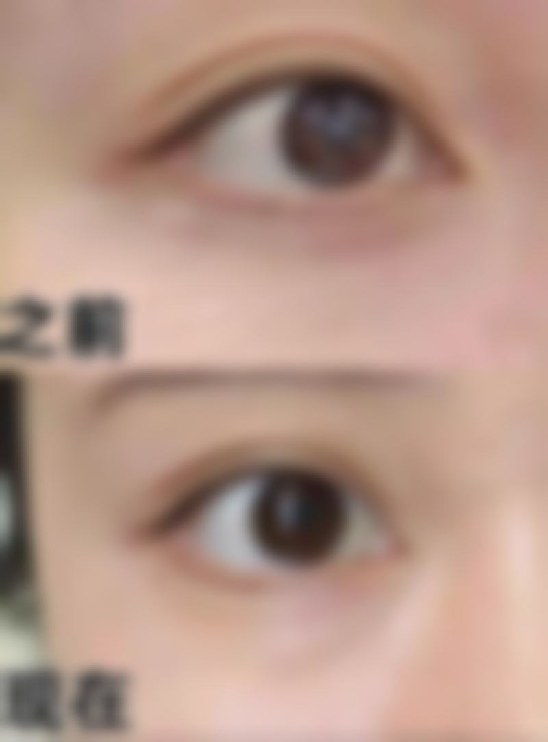 结尾预约号召:周国栋医生