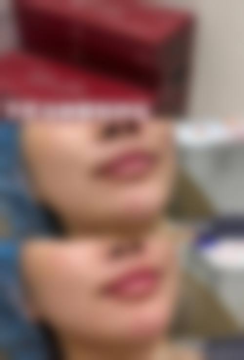 价格透明与服务保护:高性价比变得更美指南
