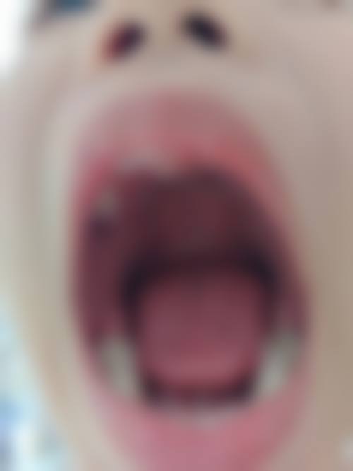 擅长项目详解