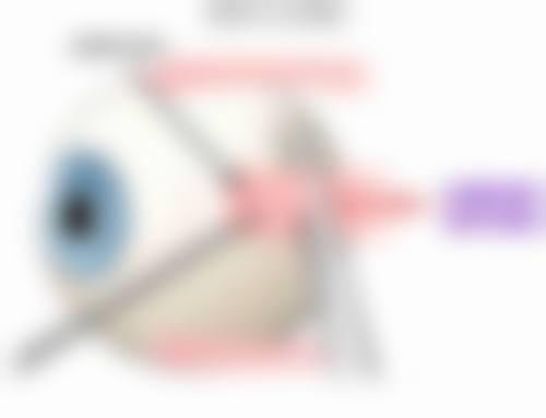 临床实例分享南京宁益眼科中 心门诊部高嶔云