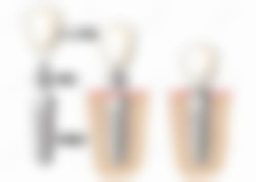 特色科室与骨干医生团队:专注数字化种植与隐形矫正