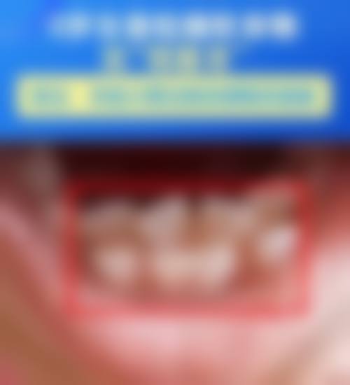 价格透明与优惠活动详情