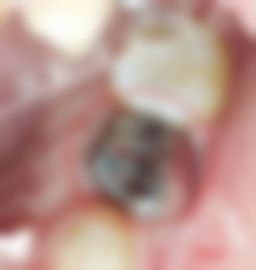 结尾预约号召北京美冠塔口腔连锁(朝阳路分院)吕占宁