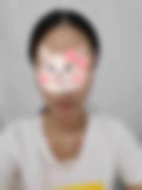 患者真实评价茂名市人民医院整形外科
