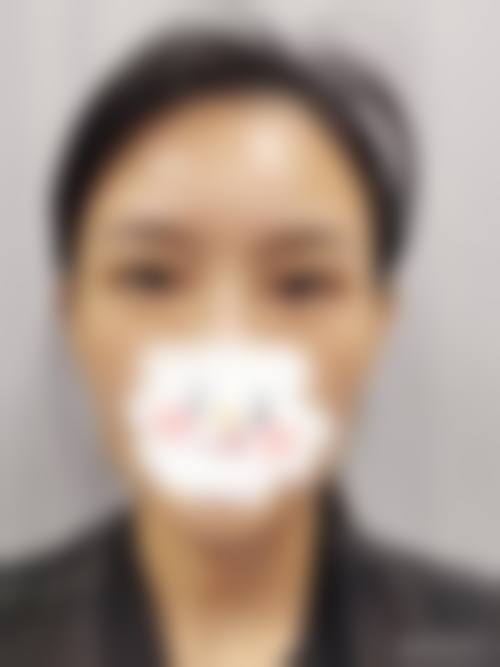 临床实例分享