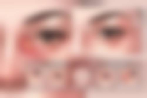 引进国内外前列设备与洁净手术室