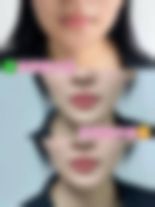 结尾预约号召：商丘市商美医疗美容孟丽华医生值得预约吗？