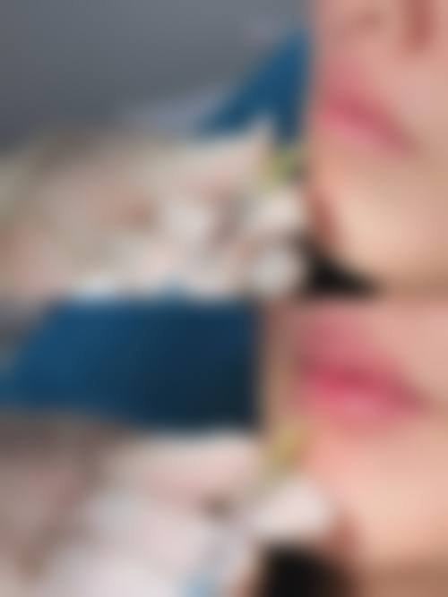 预约优惠活动:福州新世纪整形医院曹美丽