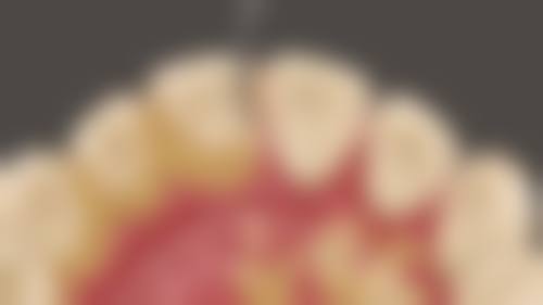 临床实例分享：真实反馈见证疗效