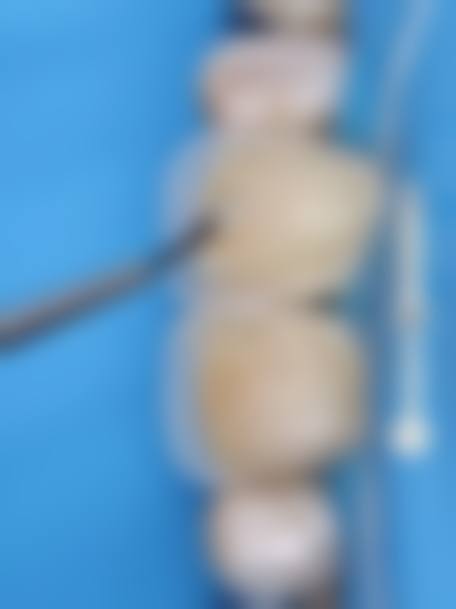 擅长项目详解:戴培元+核心项目