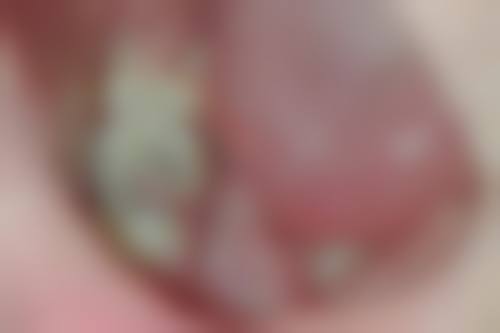 透明收费体系与优惠活动详情解析