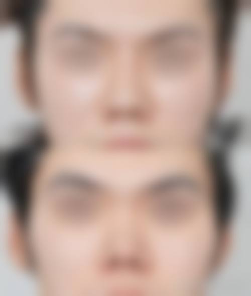预约优惠活动福州新世纪整形医院沈膺盛