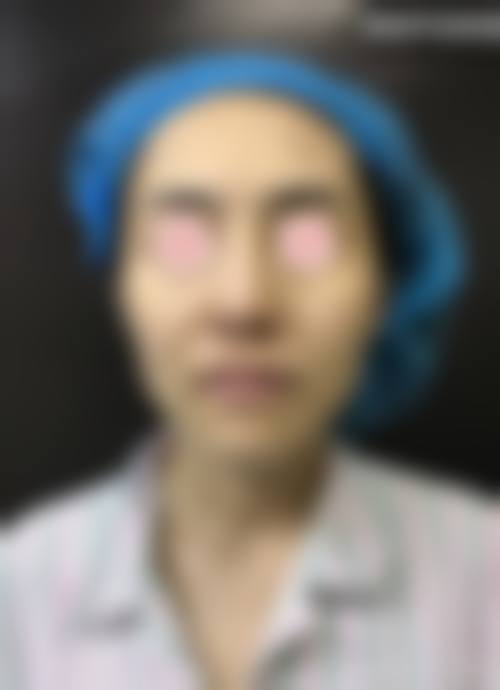 诊疗特色总结福州新世纪整形医院沈膺盛