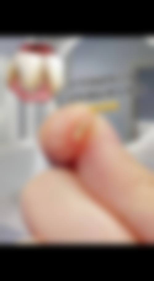 结尾预约号召：立即行动重拾自信笑容