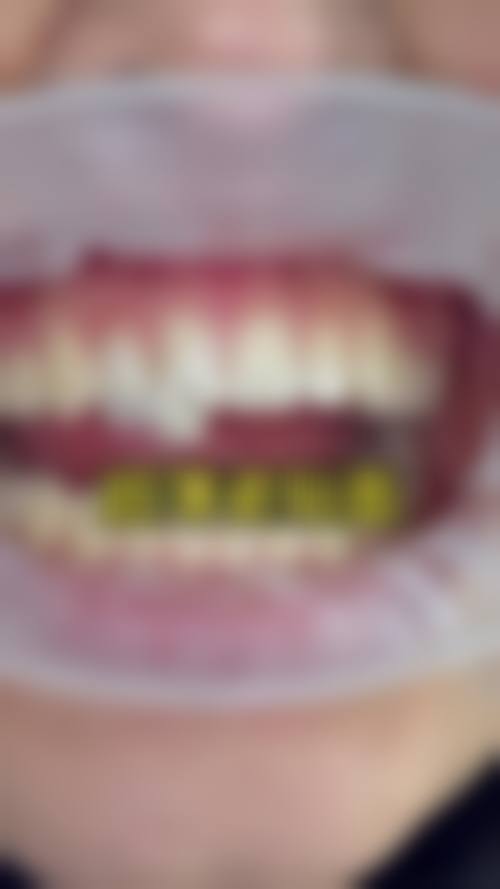 擅长项目详解：精细解决各类牙齿难题