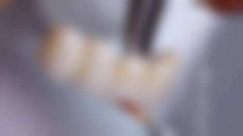 优惠活动详情