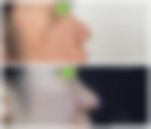 FAQ:关于广州美涵整形美容医院李铭进的高频问答