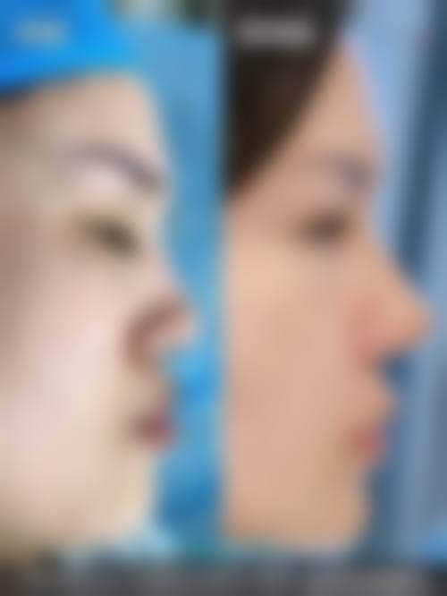 总结与预约号召