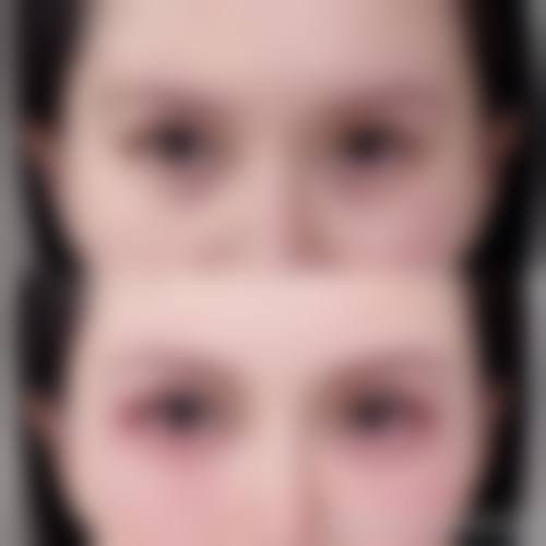 结尾预约号召福州新世纪整形医院陈志明