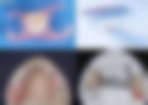 结语:选择植美口腔,开启健康新人生