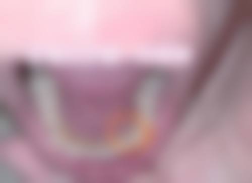 预约优惠活动