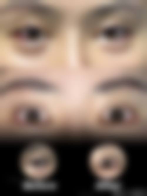 总结与预约建议