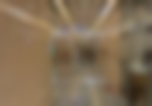 北京劲松口腔医院（望京院）活动义齿半口吸附性修复26000元起稳固咀嚼